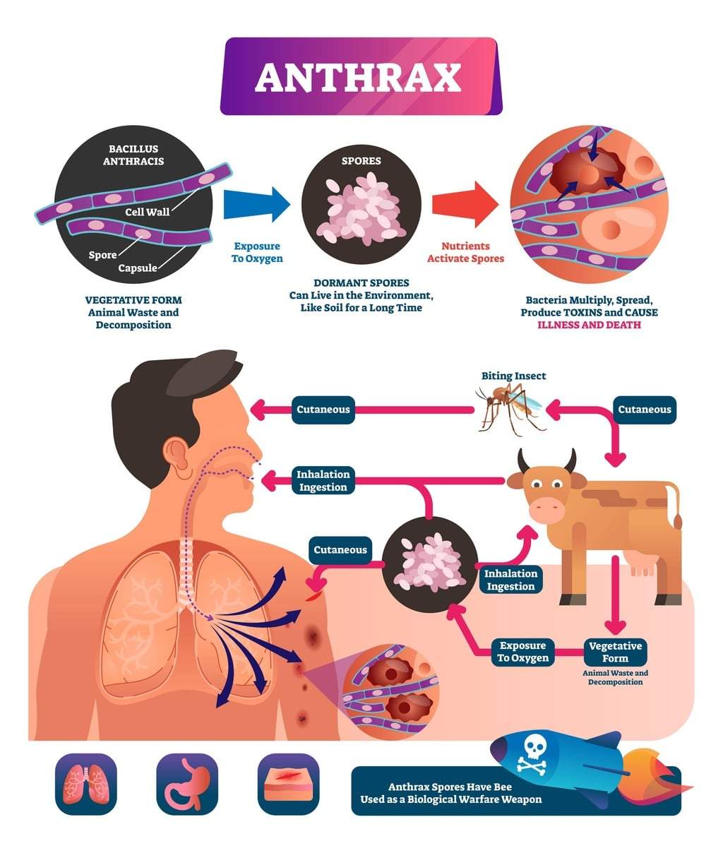All About Anthrax exposure. medical infection disease cycle scheme. Bacterial illness used as biological warfare weapons. Diagram of spores exposure to oxygen produce toxins and cause death.