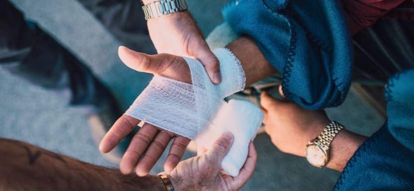 Administering first aid for a burn on someone's hand.